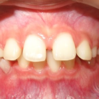 つくばこうた歯科クリニック｜歯科矯正イメージ