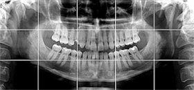 つくばこうた歯科クリニック｜最新設備機器イメージ